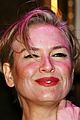 zellweger-wet