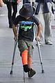 reese-crutches
