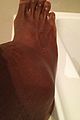 williams-ankle
