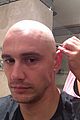 franco-bald