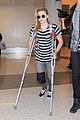 chloe-crutches