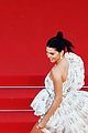 jenner-epic
