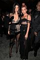 kendall-acne