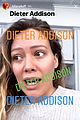 dieter-call