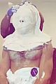 madden-plaster