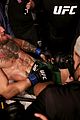 conor-leg