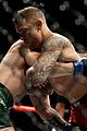 conor-leg