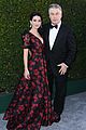 hilaria-baldwin-son-allergic-reaction