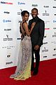 skye-emmys
