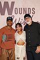 wounds-event