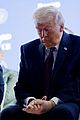 trump-bruising