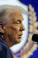 trump-bruising